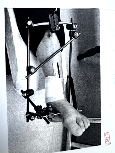 男子停车场随地小便被制止，恼羞成怒飞踹管理员致自己骨折，索赔18万余元，法院判了